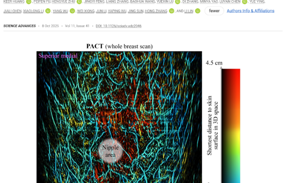 Science Advances│尖端光声成像仪器触动传统行业印象：光声+超声显著提升乳腺肿瘤早期诊断准确性